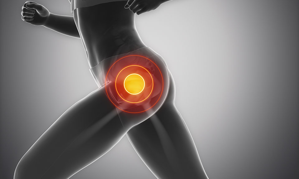 hip-pain_d2.jpg